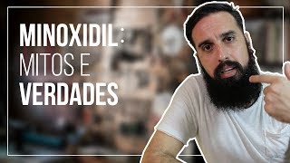 Mitos e Verdades no uso do Minoxidil [upl. by Tybie]