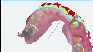 E2 Fussen IntraOral Scanner S6000 Tools [upl. by Annerahs]