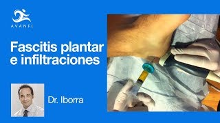 Infiltraciones para la Fascitis Plantar  Podología Dr Iborra [upl. by Arrotal]