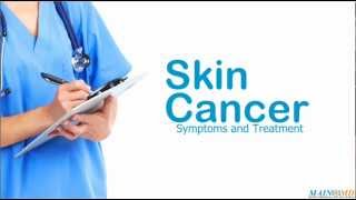 Skin Cancer Symptoms and Treatment [upl. by Oiraved400]