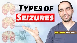 How to know if you have Epilepsy different seizure types [upl. by Glynias]