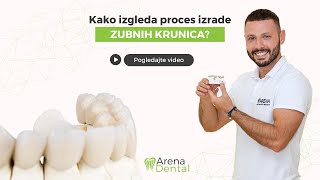 Kako izgleda proces izrade zubnih krunica  Arena Dental [upl. by Allix]