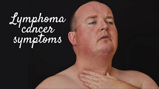 LYMPHOMA CANCER SYMPTOMS [upl. by Licec129]