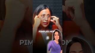 Acne face mapping  can acne show problems in internal organs  dermatologist comments [upl. by Wilone]