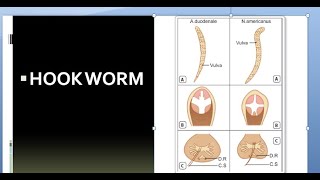 Ancylostoma Duodenale and Necator Americanus by Dr Alpa Patel Microbiology Dept GMCS [upl. by Lydon]