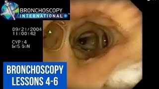 Bronchoscopy Step by Step Details Lessons 46 [upl. by Noraa532]