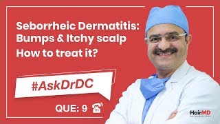 How To Treat Seborrheic Dermatitis कैसे seborrheic का इलाज करे  AskDrDc Ep 9  In HINDI [upl. by Slohcin]