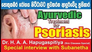 Psoriasis quot Pothu kabara quot Ayurvedic treatment sri lanka Dr HAA Hapugaspitiya [upl. by Ahsiele]