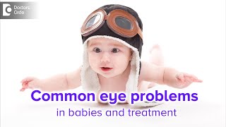 Common Eye Problems In Babies And Treatment  Dr Sunita Rana AgarwalDoctors Circle [upl. by Heringer]