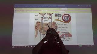 Neuroanatomy 43  Pons  part 5   by Dr Wahdan [upl. by Nylcaj]