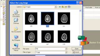 Final Year Projects  MRI BRAIN IMAGE SEGMENTATION USING MODIFIED FUZZY CMEANS CLUS [upl. by Pinelli506]