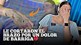 CUENTA COMO PERDIÓ SU BRAZO POR UN DOLOR DE ESTÓMAGO NEGLIGENCIA MÉDICA [upl. by Melody]