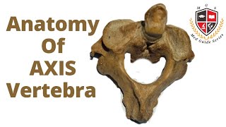 Axis Vertebra Anatomy 2nd Cervical VertebraHuman Osteology [upl. by Eimirej262]