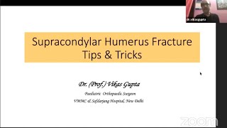 Dr Vikas Gupta  Supracondylar humerus fracture Tips amp Tricks [upl. by Leola556]