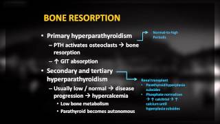 21 Hypercalcemia [upl. by Annil]