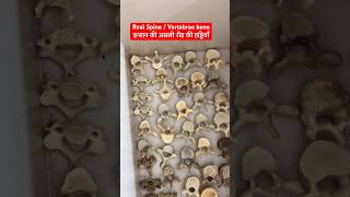 इन्सान की असली रीढ़ की हड्डियाँ  Human Real Spine  Vertebral bone Cervical Lumbar viral shorts [upl. by Edette]