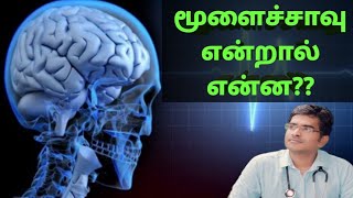 மூளைச் சாவு என்றால் என்ன examination in detailmedical awareness in Tamil [upl. by Ardie]