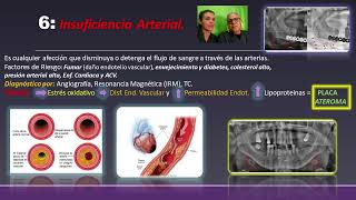 Sindrome por AplastamientoEnfermedad por DescompresiónInsuficiencia Arterial [upl. by Omrellug]