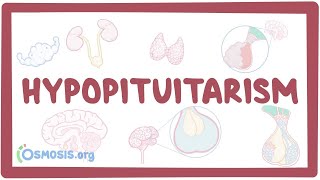 Hypopituitarism  causes symptoms diagnosis treatment pathology [upl. by Johnath]