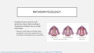 Common Perioperative Complications Keyword Review  Dr Green [upl. by Biddick]