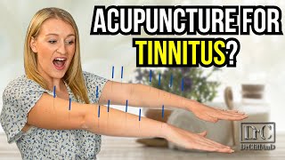 Acupuncture Treatment for Tinnitus [upl. by Sherris]