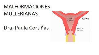 Malformaciones Mullerianas Clase postgrado HUC [upl. by Eitnom]