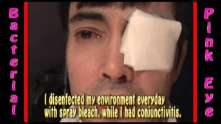 Severe Bacterial Pink Eye Conjunctivitis treatment part 7 [upl. by Shandie369]