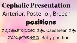 Cephalic presentation of babyBaby position Baby position for normal delivery in malayalam [upl. by Ztnaj]