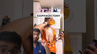 DOCTOR REACTS to ESOPHAGECTOMY and ESOPHAGOSTOMY [upl. by Karole]