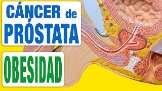 Cáncer de Próstata y Obesidad [upl. by Al835]