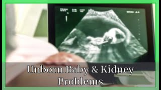 Unborn Baby amp Kidney ProblemsKidney deseases Very Well [upl. by Rania]