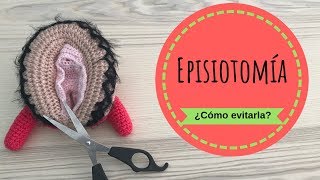 La EPISIOTOMIA ✂️ ¿cómo puedo evitarla [upl. by Anuayek]