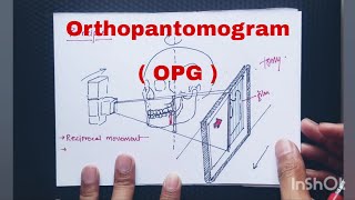 Orthopantomogram  OPG  Part 1  Hindi  Principles Focal Trough Ghost image [upl. by Gwenora]