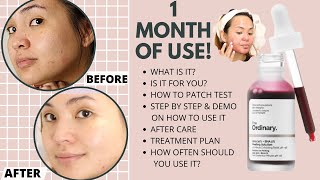 How to use The Ordinary AHA 30  BHA 2 Peeling Solution 2023  SHOCKING BEFORE AND AFTER [upl. by Goldie]