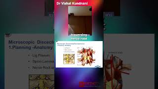 BOS Dr L N Vora Master Series Microdiscectomy vs Microendoscopic Discectomy  Dr Vishal Kundnani [upl. by Kit847]