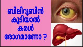 Does high bilirubin always mean liver disease Malayalam [upl. by Ennaeilsel]