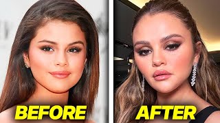 Selena Gomez PLASTIC SURGERY Backlash fans arent loving it [upl. by Jessamine]