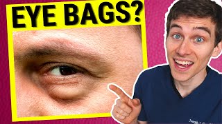 Eye Doctor Explains How to Get Rid of Under EYE BAGS [upl. by Christianson]