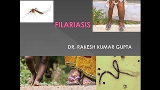 Filariasis cause symptoms diagnosis and treatment [upl. by Birkle]