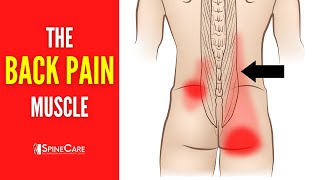 The Lower Back Pain Muscle How to Release It for INSTANT RELIEF [upl. by Eltsyek]