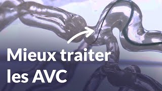 Une fibre biomédicale étudie les caillots sanguins pour comprendre les causes dun AVC  Reportage [upl. by Merri]