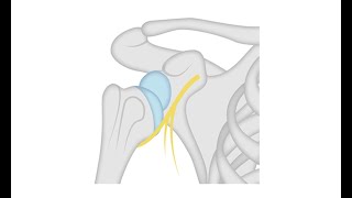 Diagnosing a shoulder dislocation [upl. by Nahpets197]