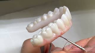 Implant Bridges Zirconia Monolithic Double Full Arch Tutorial [upl. by Nyladgam962]