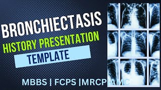 Bronchiectasis History Presentation Template  MBBS  MRCP FCPS MSMD [upl. by Idorb]