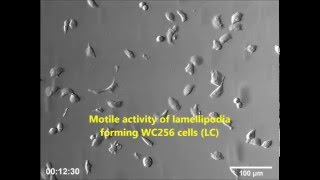 Lamellipodia and Membrane Blebs Drive Efficient Electrotactic Migration of Rat Walker Carcinosarcoma [upl. by Trey]