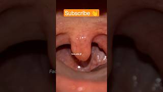 Uvula Function 🤩 shorts factsinhindi ytshorts factshorts facts mouth uvula saliva teeth [upl. by Handbook]