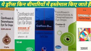 Ciprofloxacin amp dexamethasone eyeear drops  ciplox d drops  zoxan d drops  ceflox dee drops [upl. by Killarney]