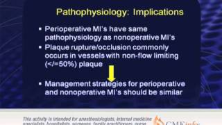 Perioperative Management [upl. by Eneirda]