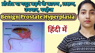 Benign prostate hyperplasia in hindi  CausesSymptomsTreatmentPreventionMsn [upl. by Arotahs765]