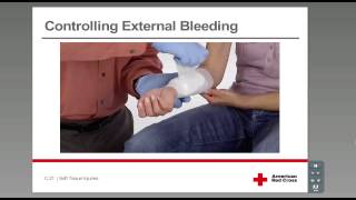 Controlling External Bleeding [upl. by Adnalra]